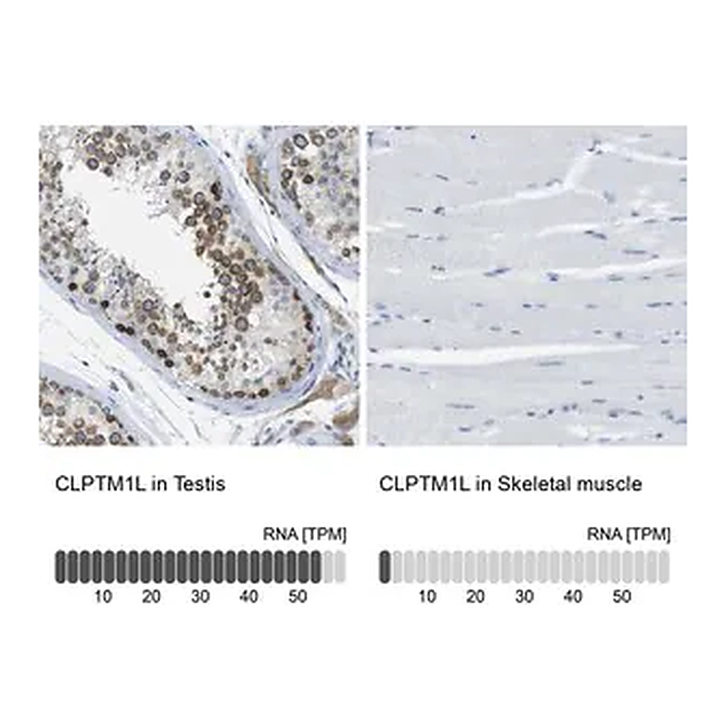 Merck Anti-CLPTM1L antibody produced in rabbit
