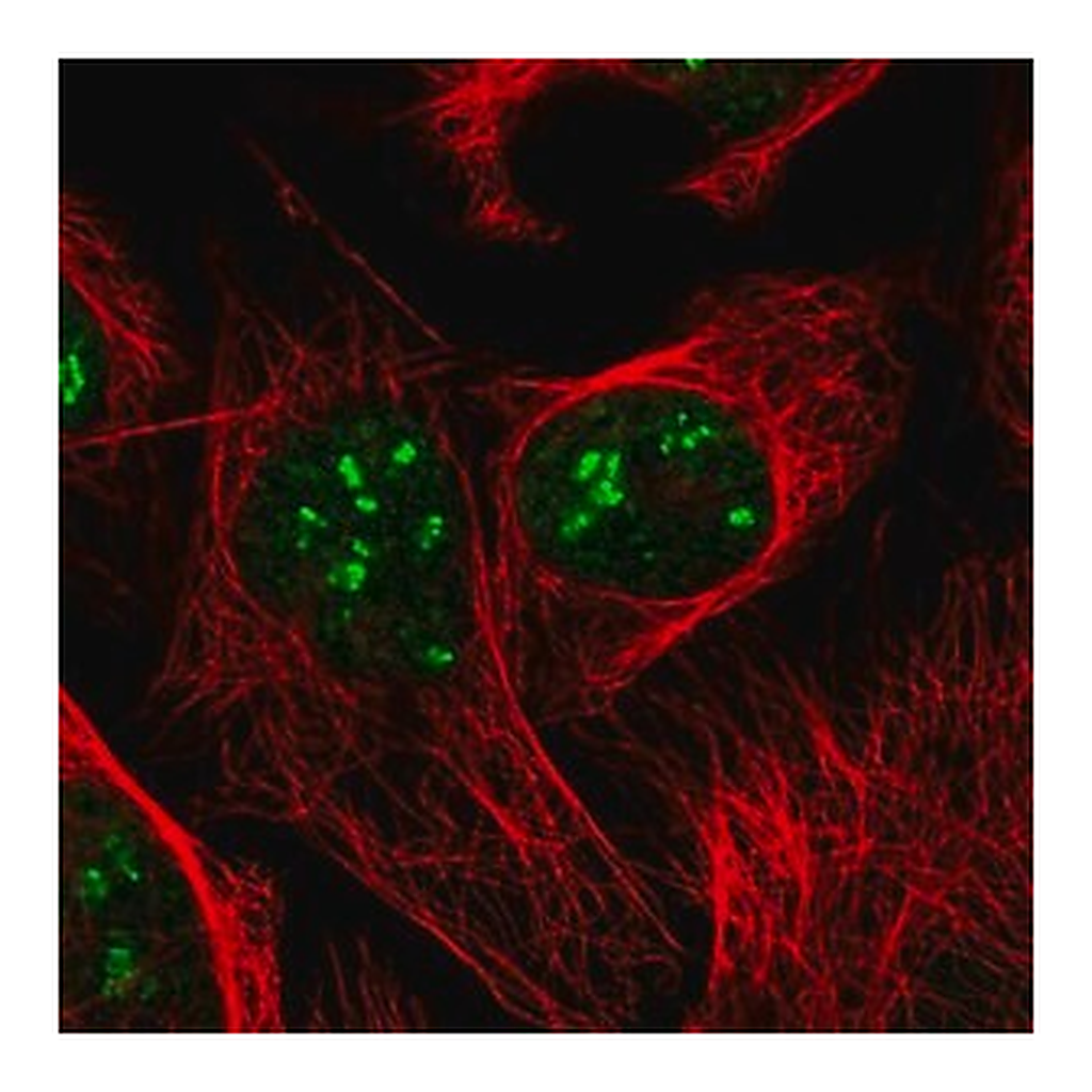 Merck Anti-DKC1 antibody produced in rabbit