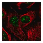 Merck Anti-DKC1 antibody produced in rabbit