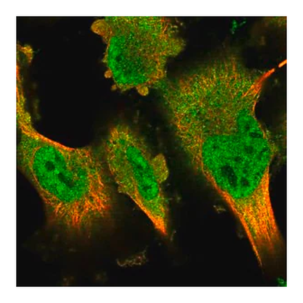 Merck Anti-DYRK2 antibody produced in rabbit