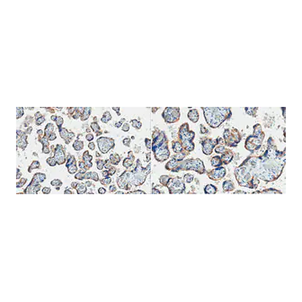 Merck Anti-EGFR Antibody