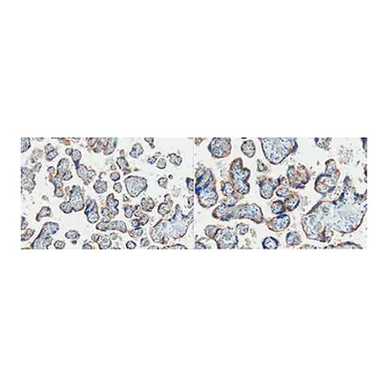 Merck Anti-EGFR Antibody