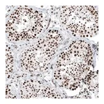 Merck Anti-KMT5C antibody produced in rabbit