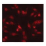 Merck Anti-Twist1 antibody produced in rabbit
