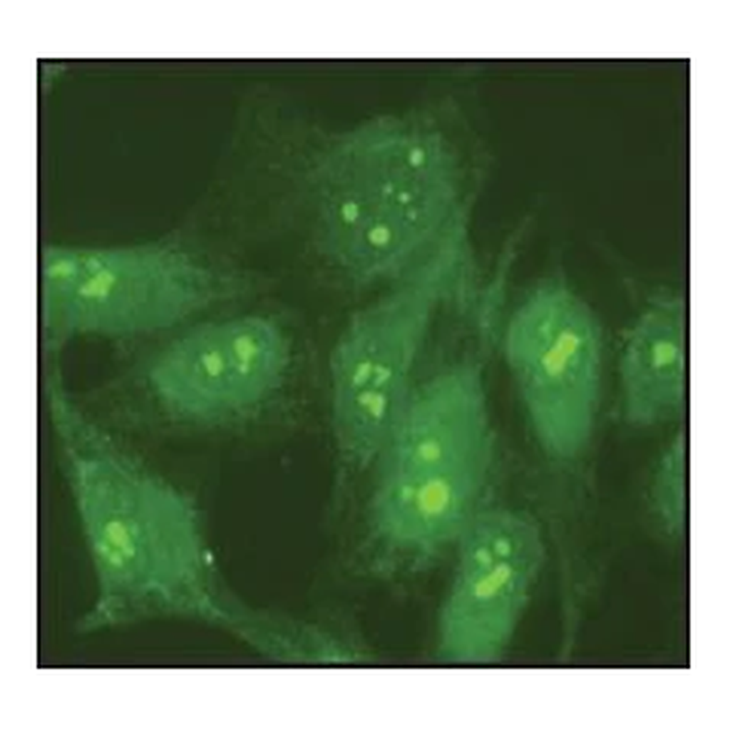 Merck Anti-Nucleolin antibody produced in rabbit
