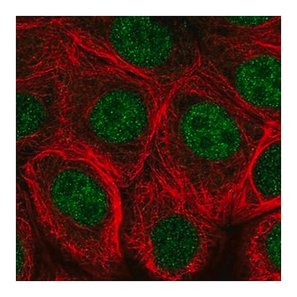 Merck Anti-MNX1 antibody produced in rabbit