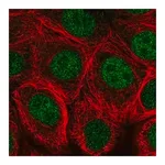 Merck Anti-MNX1 antibody produced in rabbit