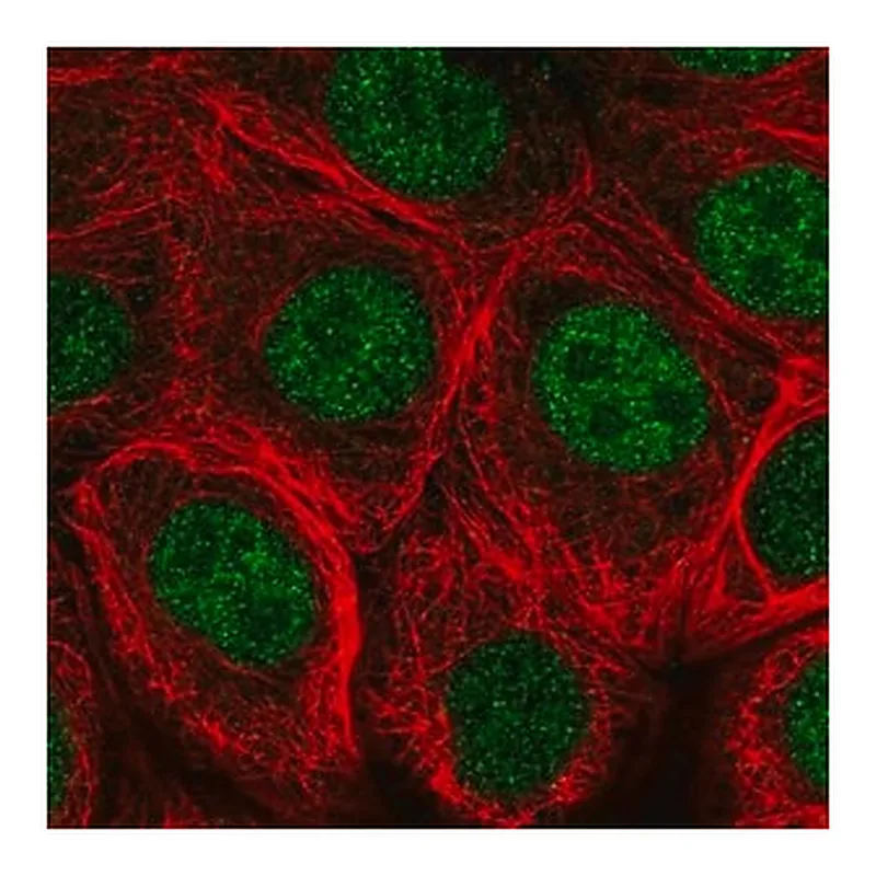 Merck Anti-MNX1 antibody produced in rabbit
