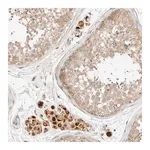 Merck Anti-SARM1 antibody produced in rabbit