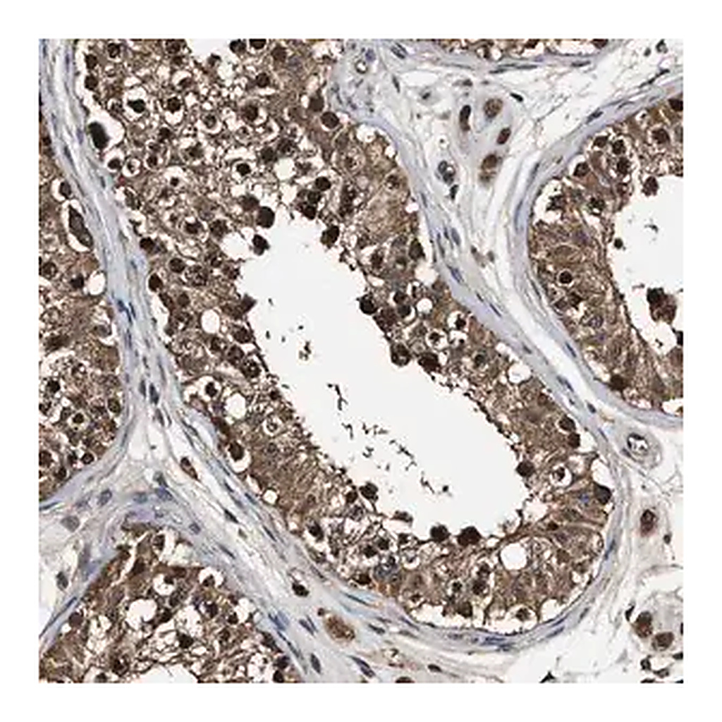 Merck Anti-RNF114 antibody produced in rabbit