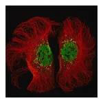 Merck Monoclonal Anti-KMT2D antibody produced in mouse