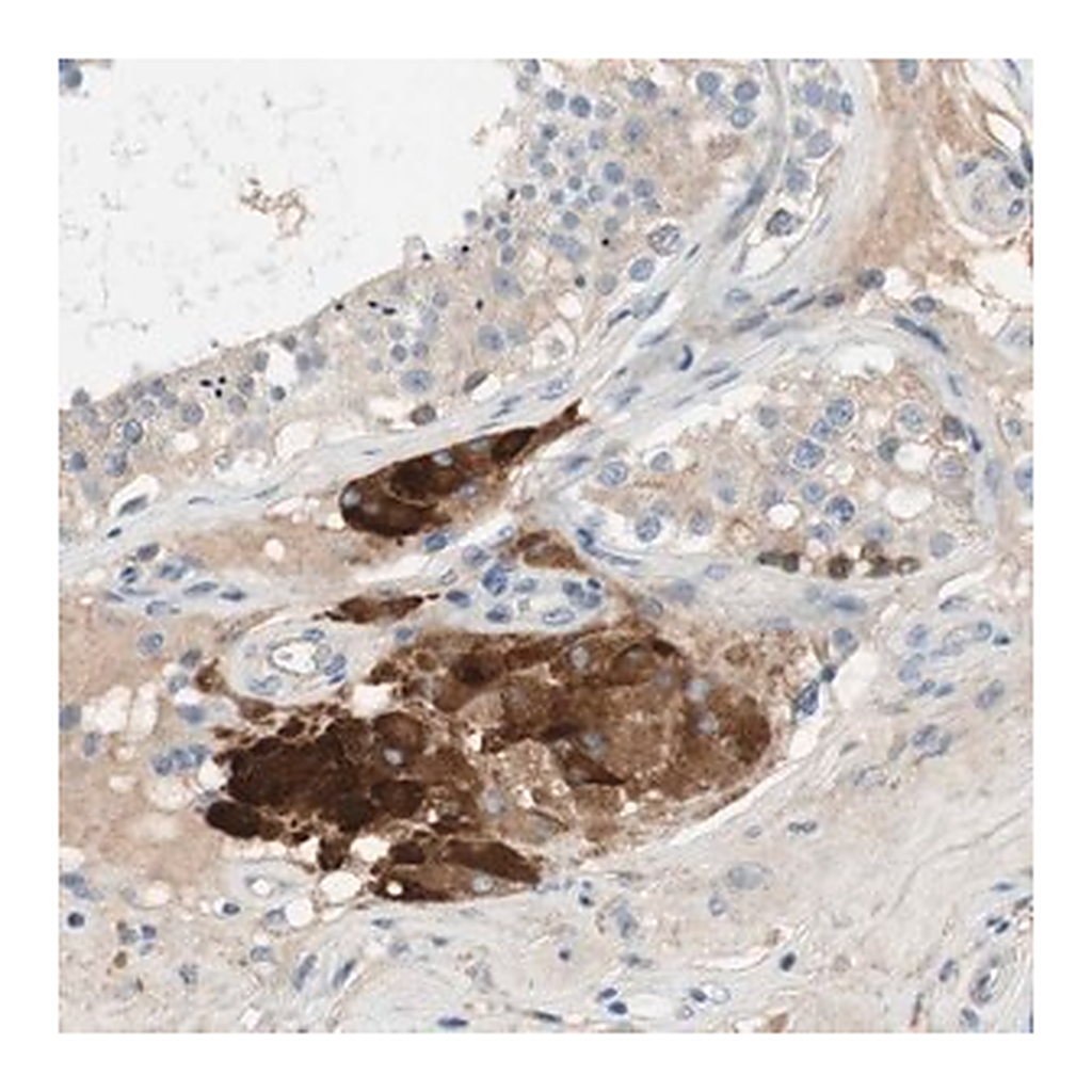 Merck Anti-FDFT1 antibody produced in rabbit