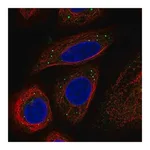 Merck Anti-BRAF antibody produced in rabbit
