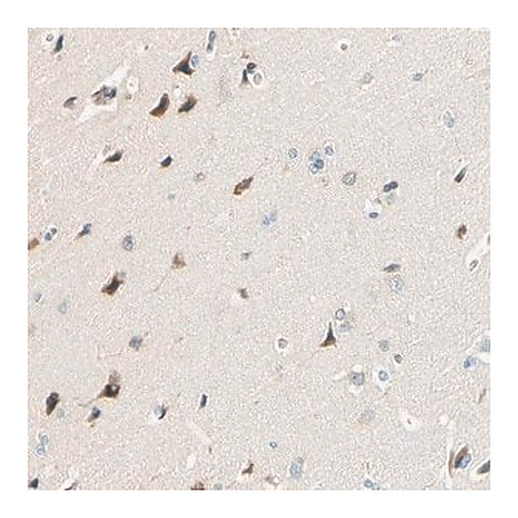 Merck Anti-TAOK2 antibody produced in rabbit