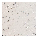 Merck Anti-TAOK2 antibody produced in rabbit