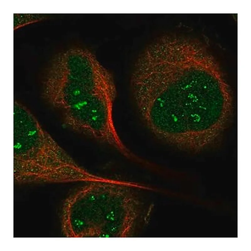 Merck Anti-IP6K1 antibody produced in rabbit