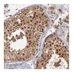 Merck Anti-HUWE1 antibody produced in rabbit