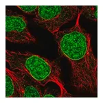 Merck Anti-DUSP2 antibody produced in rabbit