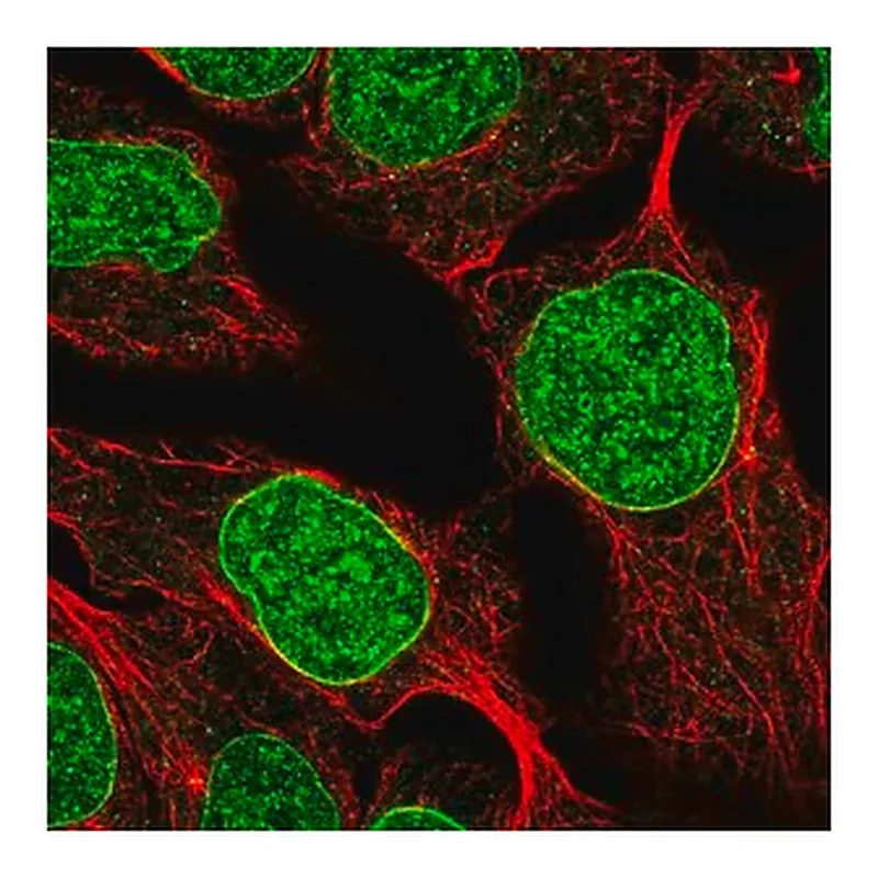 Merck Anti-DUSP2 antibody produced in rabbit