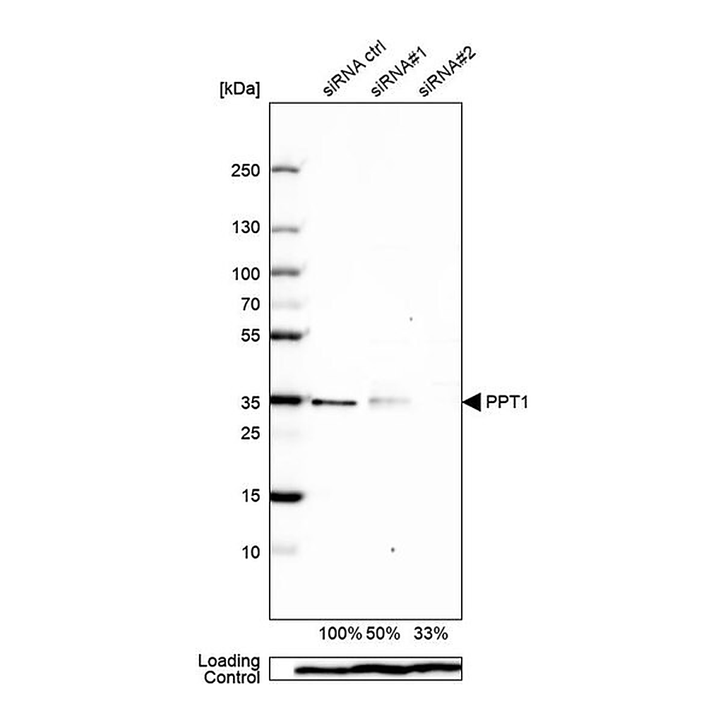 Merck Anti-PPT1 antibody produced in rabbit