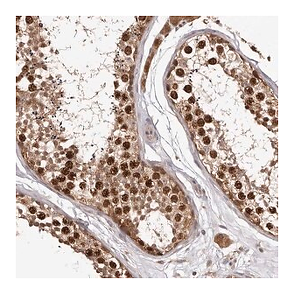 Merck Anti-RNF187 antibody produced in rabbit