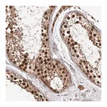 Merck Anti-RNF187 antibody produced in rabbit