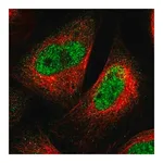 Merck Anti-SPRTN antibody produced in rabbit