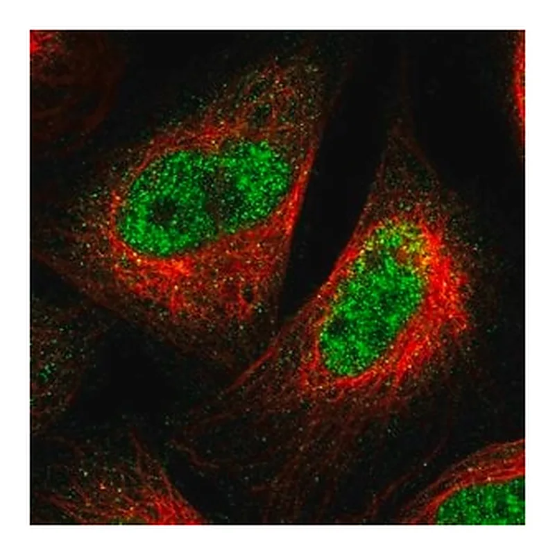 Merck Anti-SPRTN antibody produced in rabbit