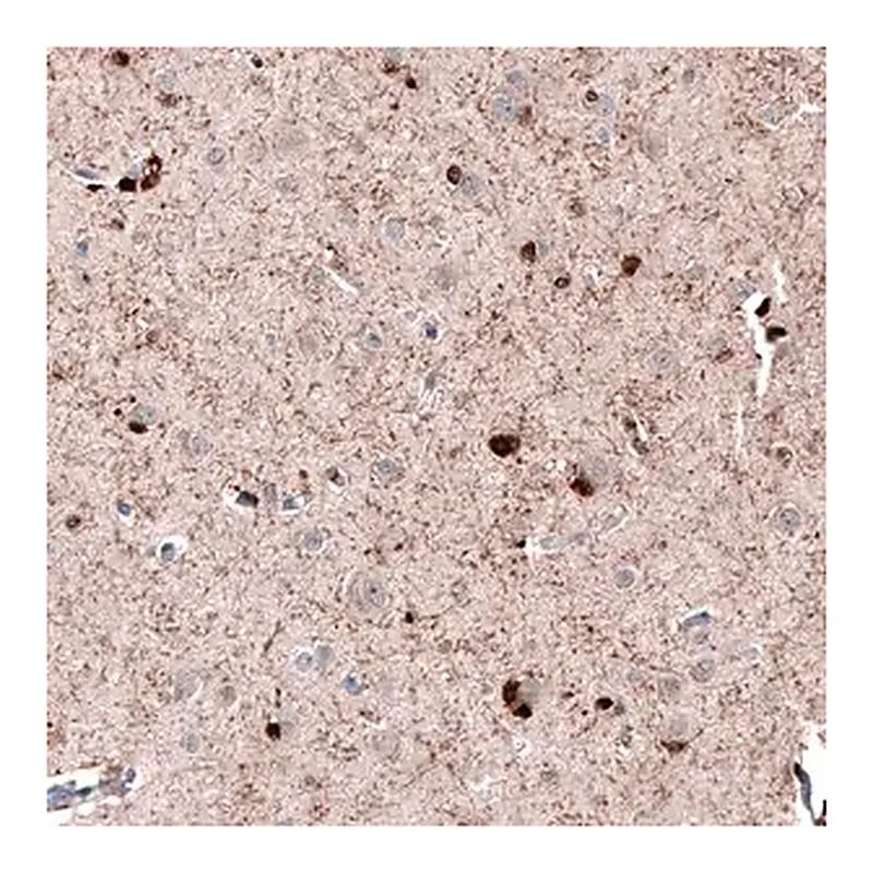 Merck Anti-ROBO2 antibody produced in rabbit