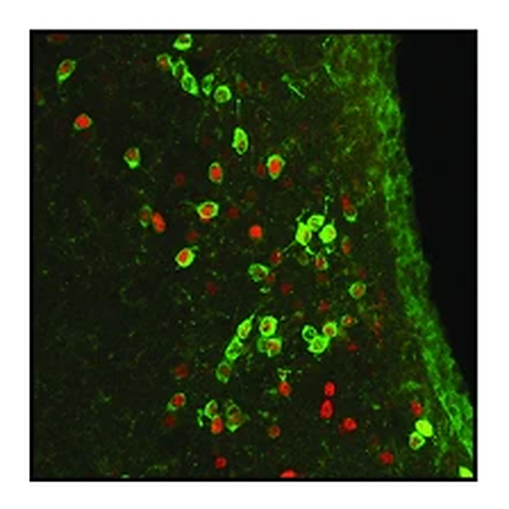 Merck Anti-ARP2 antibody, Mouse monoclonal