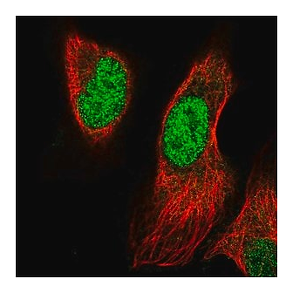 Merck Anti-PRRX1 antibody produced in rabbit