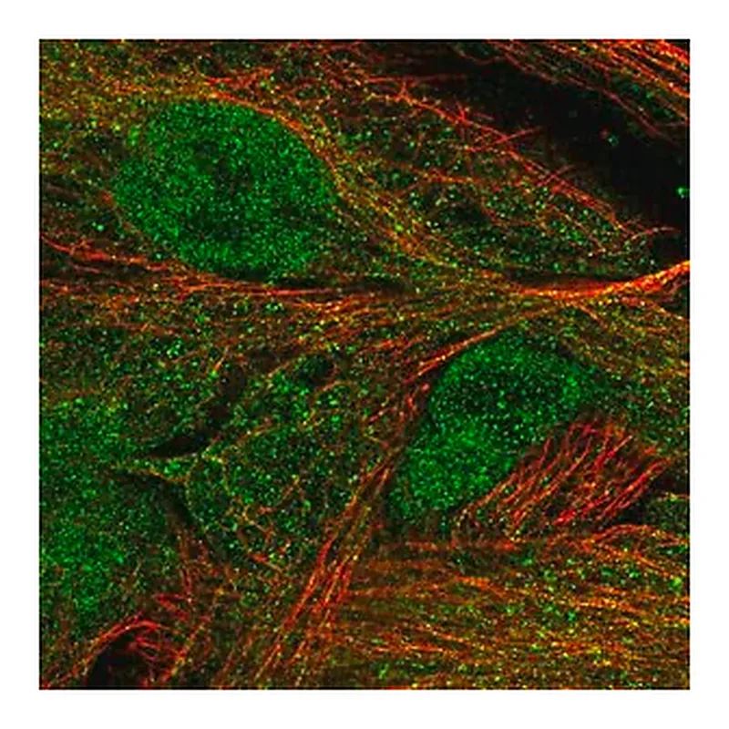 Merck Anti-MASP1 antibody produced in rabbit