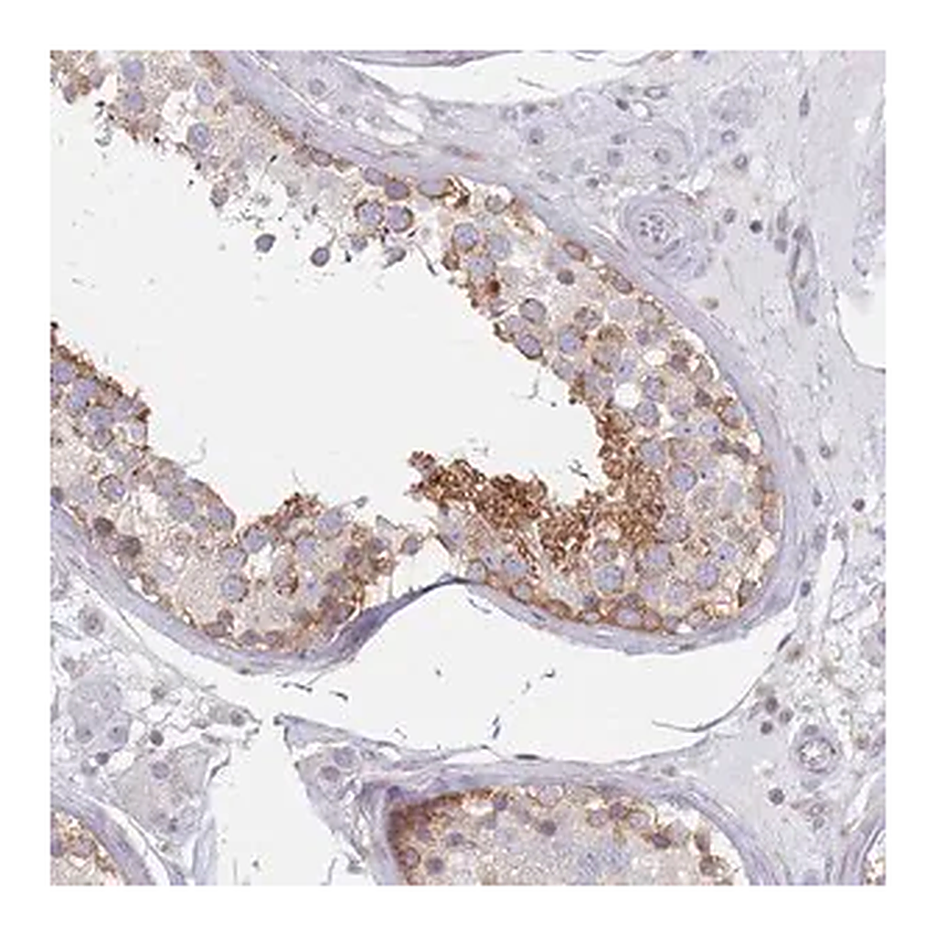 Merck Anti-MAP1S antibody produced in rabbit