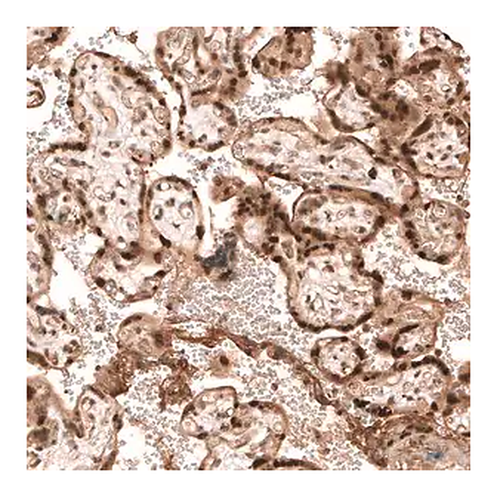 Merck Anti-PARP14 antibody produced in rabbit
