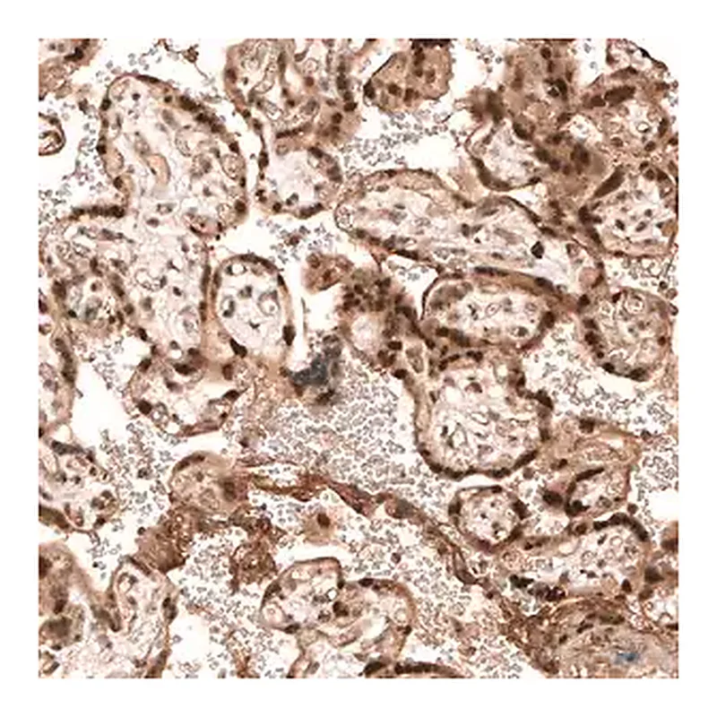 Merck Anti-PARP14 antibody produced in rabbit