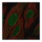 Merck Anti-UBN1 antibody produced in rabbit