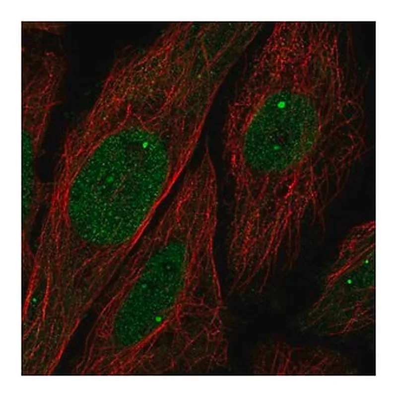 Merck Anti-UBN1 antibody produced in rabbit