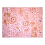 Merck Anti-PDGFR Antibody, clone CH-3