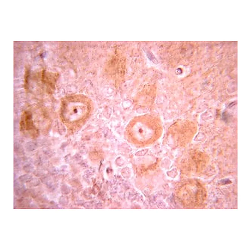 Merck Anti-PDGFR Antibody, clone CH-3