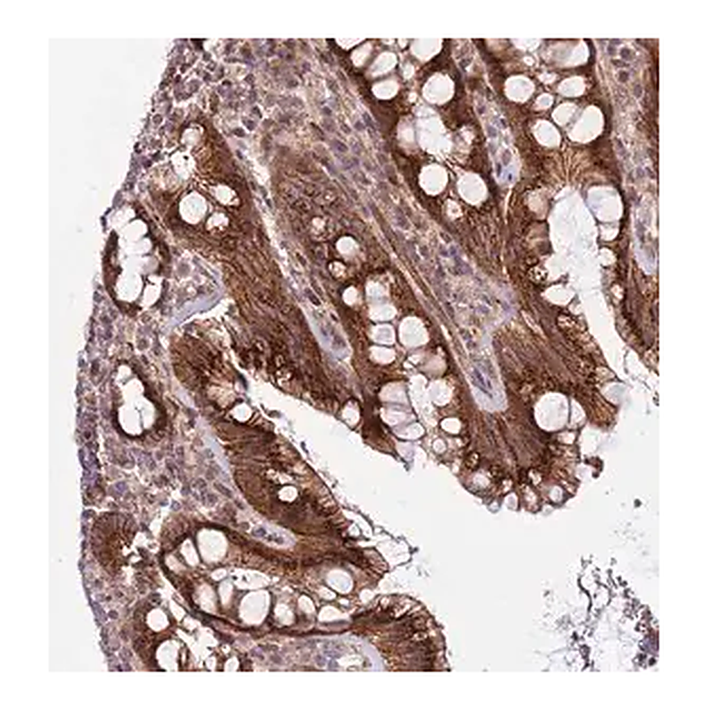 Merck Anti-ITGB6 antibody produced in rabbit