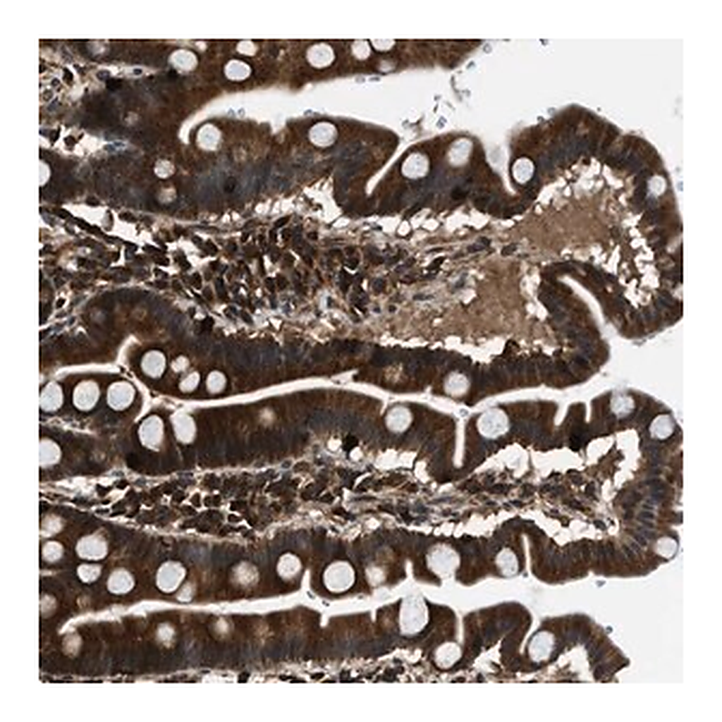 Merck Anti-PNPLA8 antibody produced in rabbit