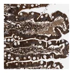 Merck Anti-PNPLA8 antibody produced in rabbit