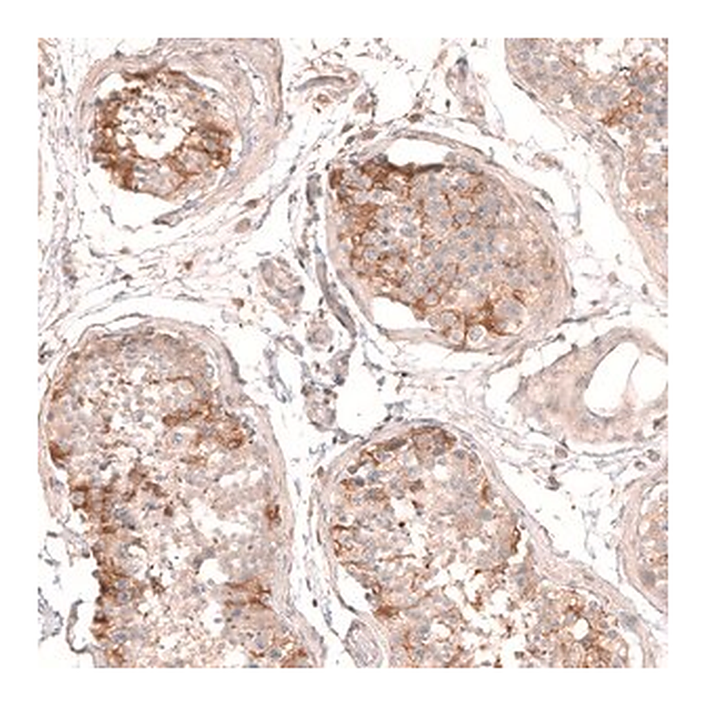Merck Anti-MTM1 antibody produced in rabbit