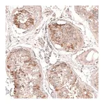 Merck Anti-MTM1 antibody produced in rabbit
