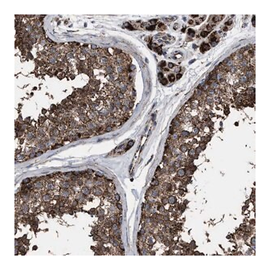 Merck Anti-VPS13A antibody produced in rabbit