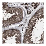 Merck Anti-VPS13A antibody produced in rabbit