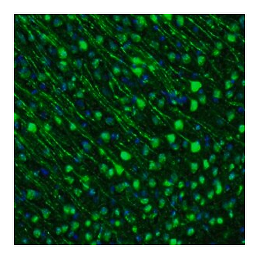 Merck Anti-GMFB antibody produced in rabbit