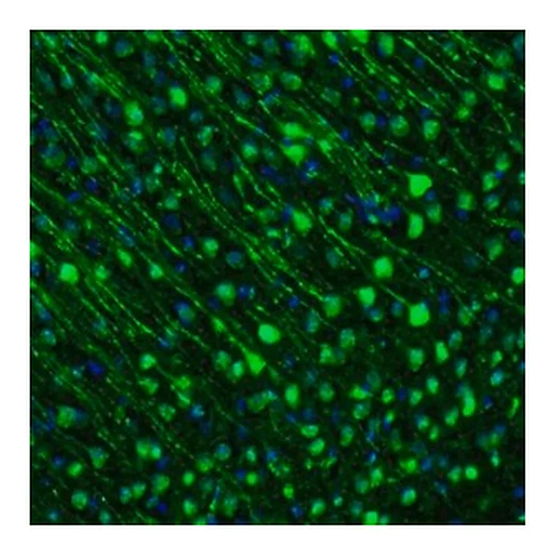 Merck Anti-GMFB antibody produced in rabbit