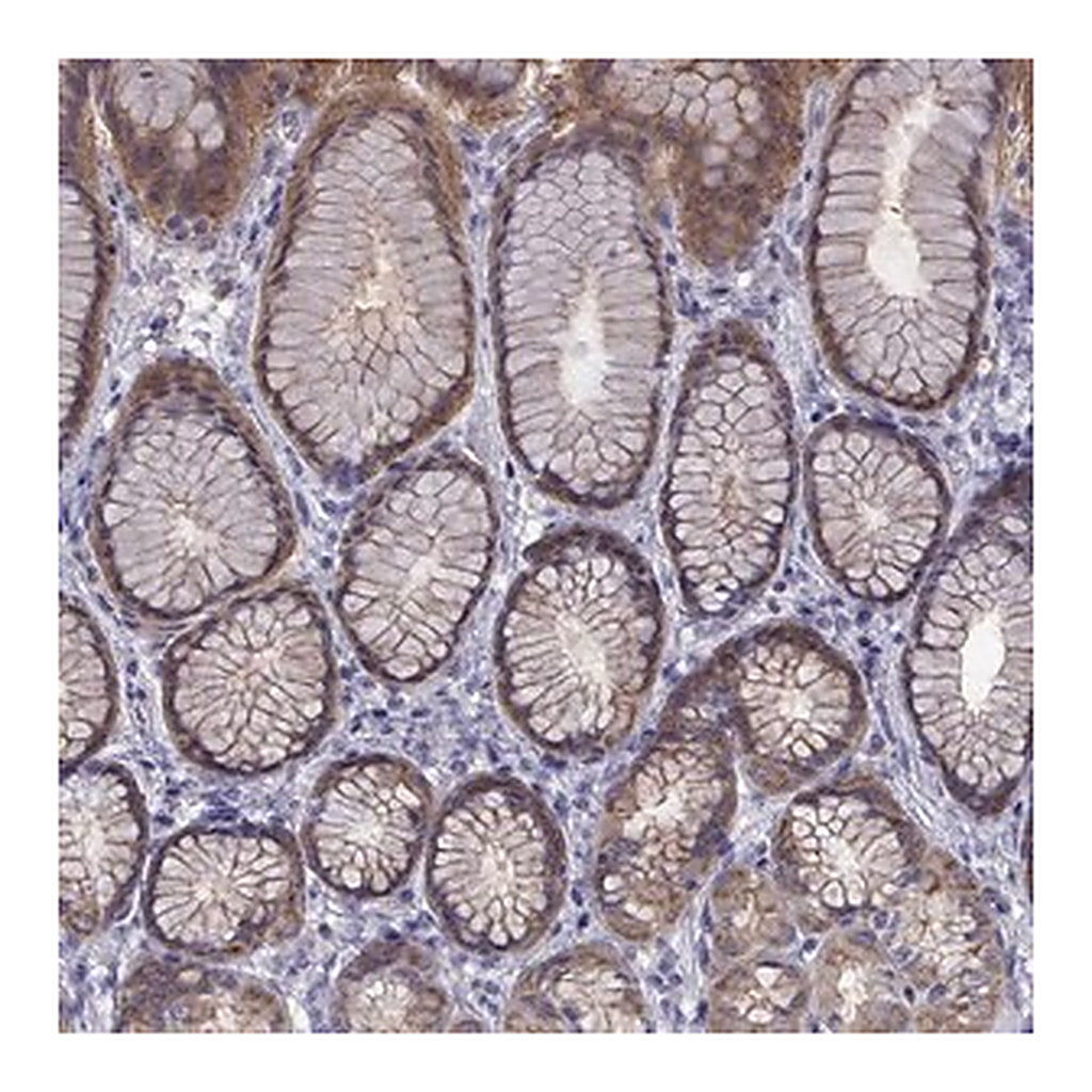 Merck Anti-COL22A1 antibody produced in rabbit