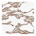Merck Anti-TYK2 antibody produced in rabbit